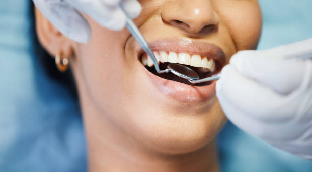 Best Emergency Tooth Extraction in San Luis Obispo, CA